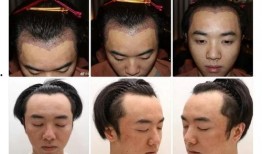 整容爆料大全视频下载安装,视频下载安装全攻略